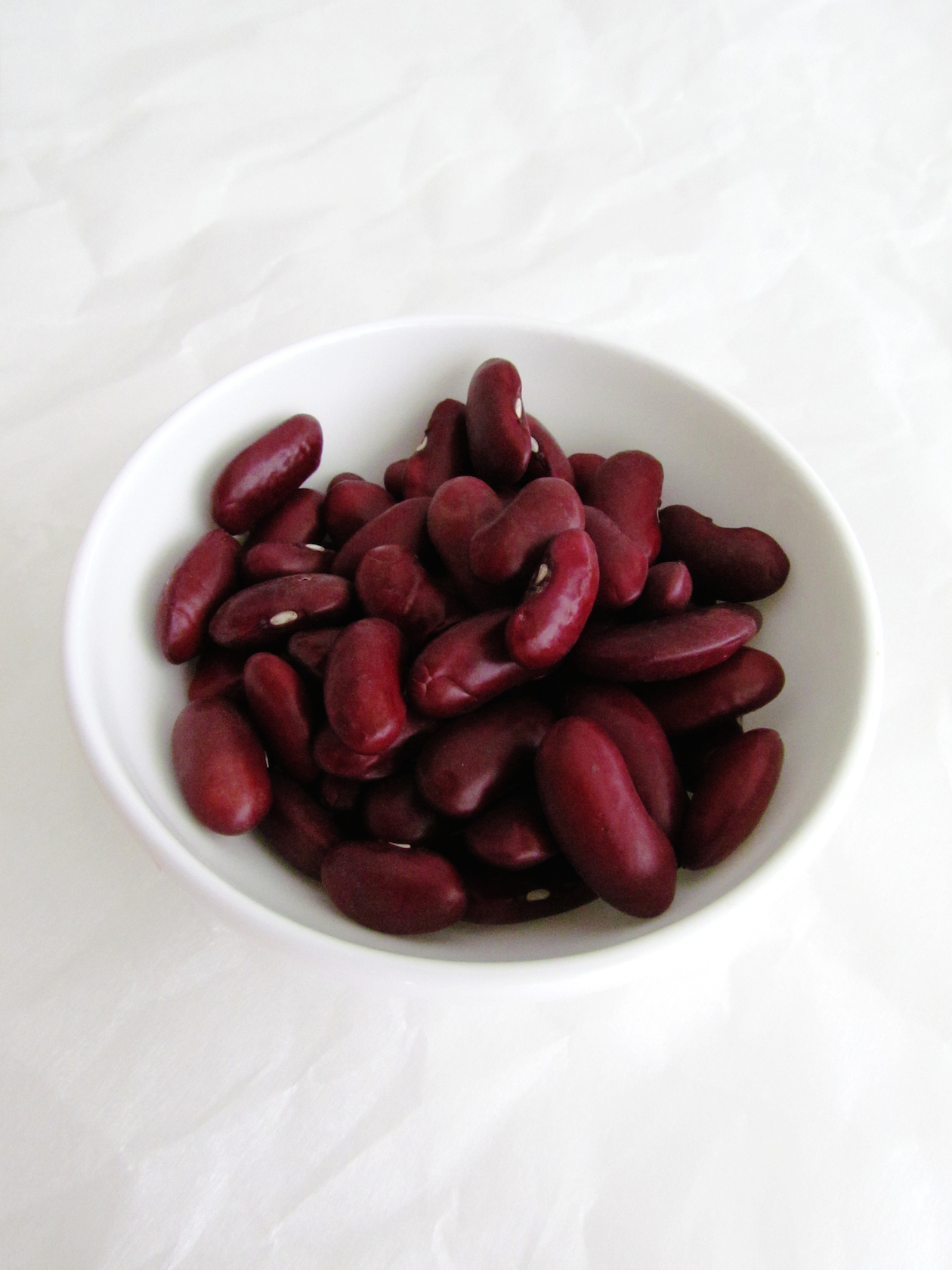 Fatty liver weight loss surgery image 8